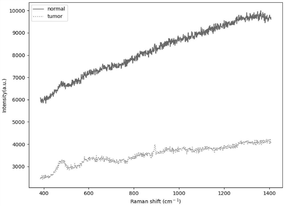 Tumor detection method based on Raman spectrum and convolutional neural network