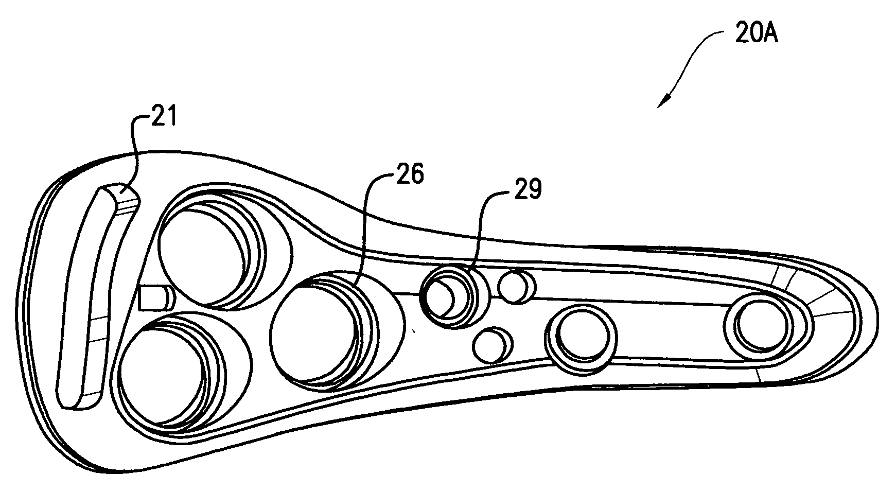 Hip fracture device with static locking mechanism allowing compression