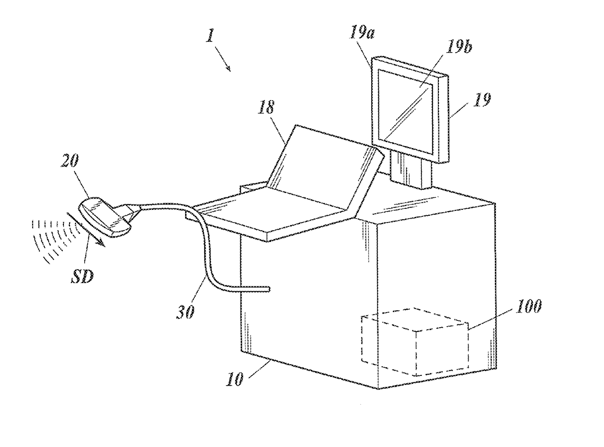 Ultrasound diagnostic apparatus