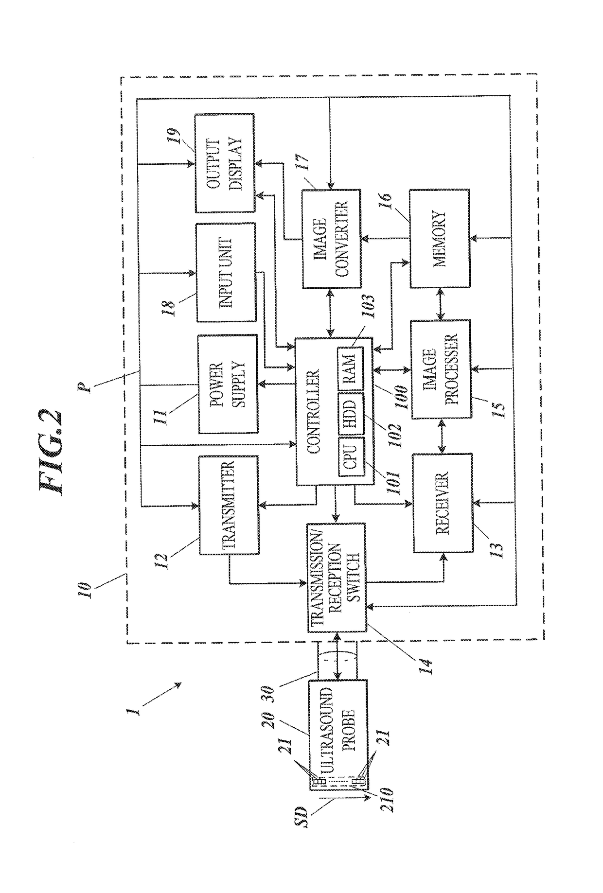 Ultrasound diagnostic apparatus