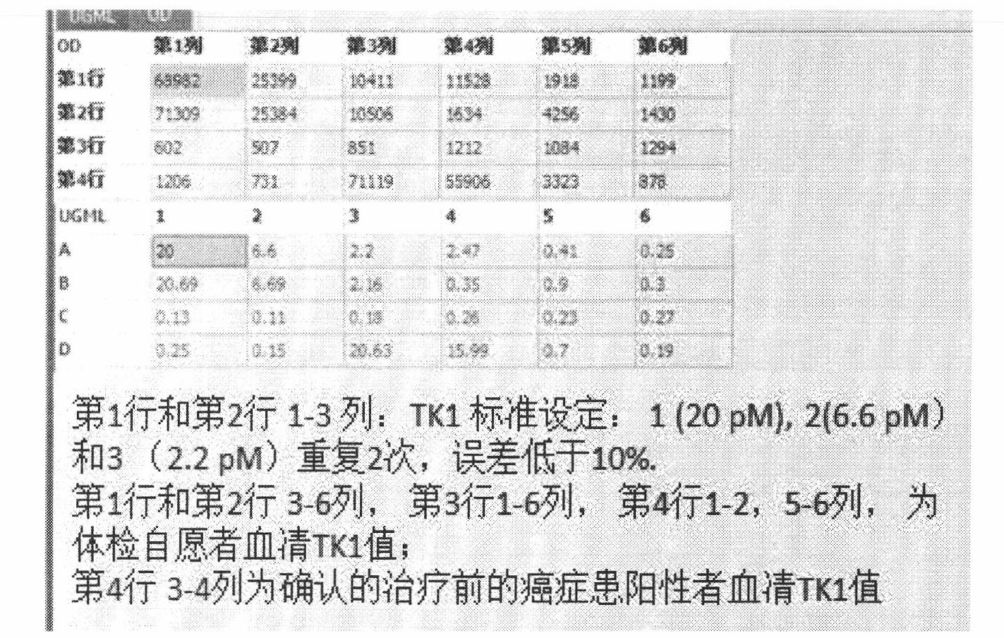 Preparation of multi-epitope thymidine kinase 1 (TK1) antibody and use of multi-epitope TK1 antibody for early tumor detection and risk early warning in mass physical examination screening