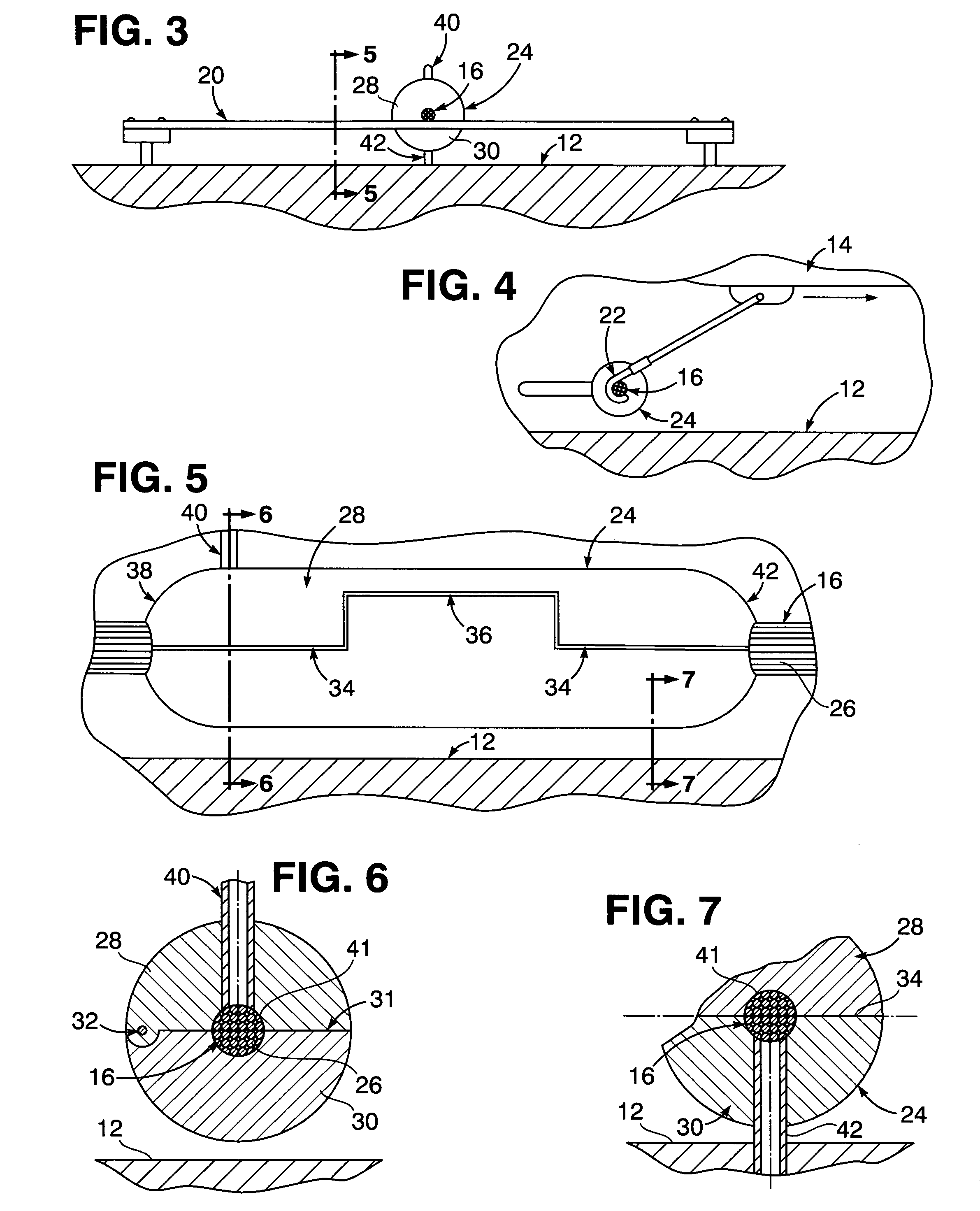 Wear resisting sleeve system for aircraft landing arresting cables