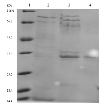 High-stability organic solvent-resistant lipase producing strain and lipase as well as gene and application thereof