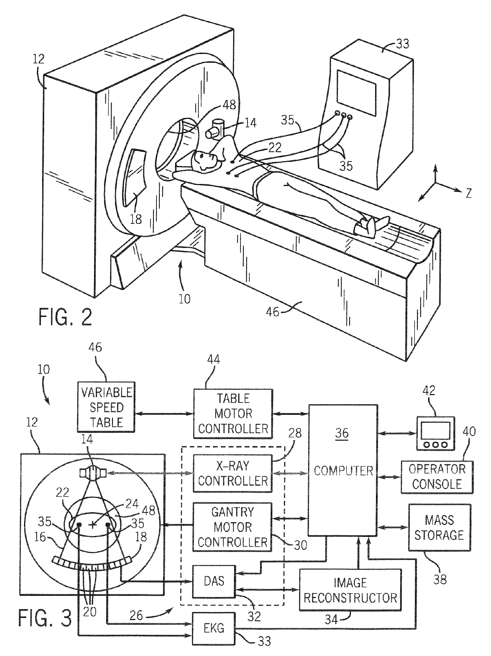 Step-and-shoot cardiac CT imaging