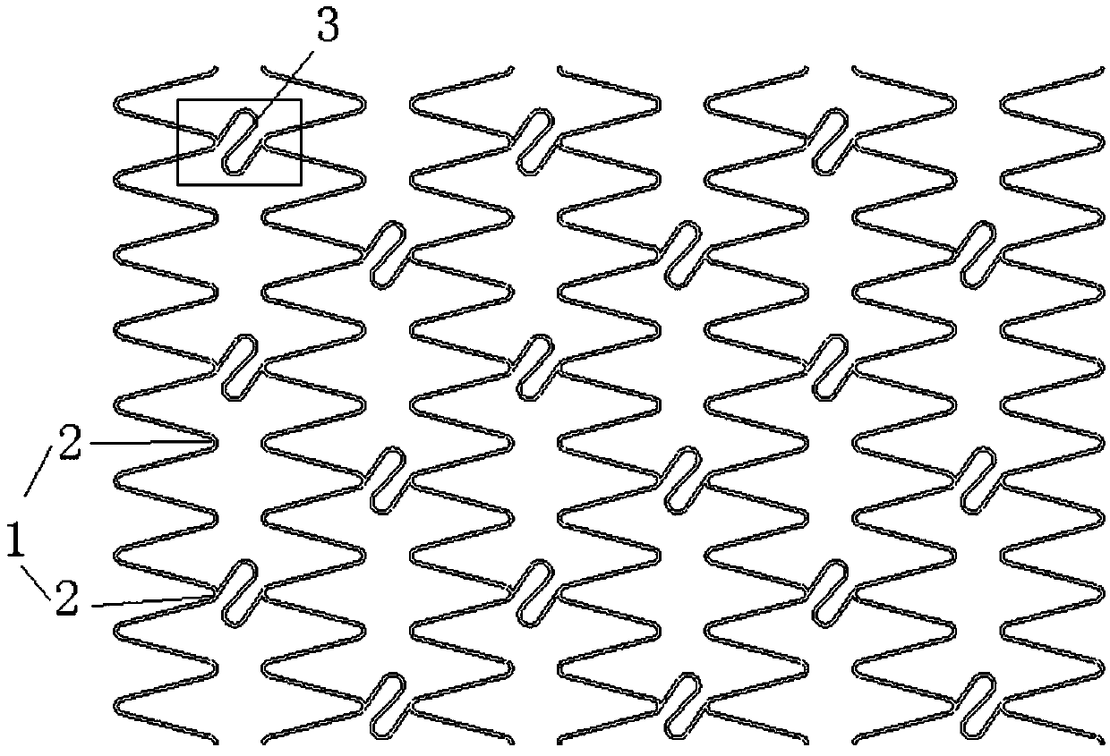 Vascular stent