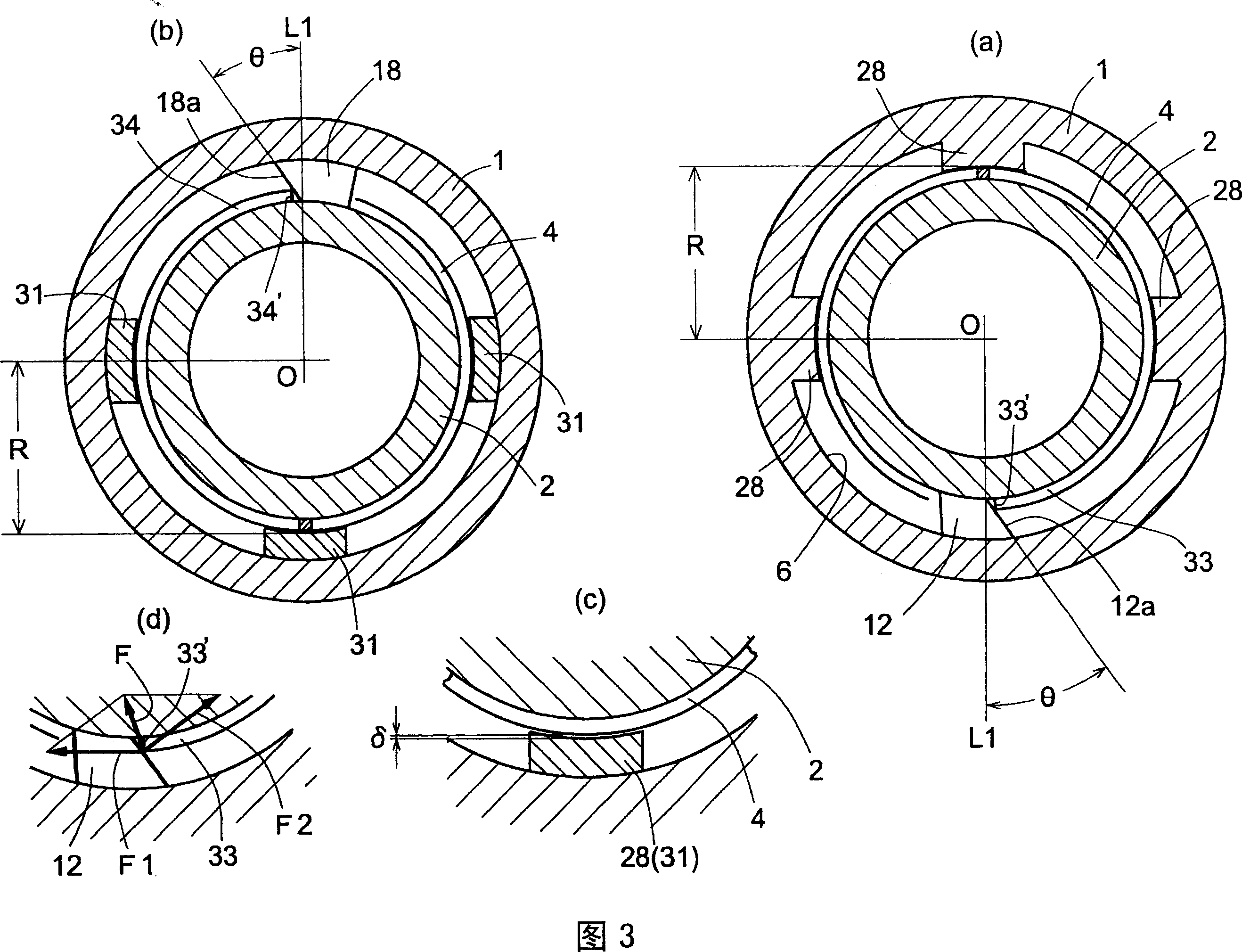 Torque restrictor