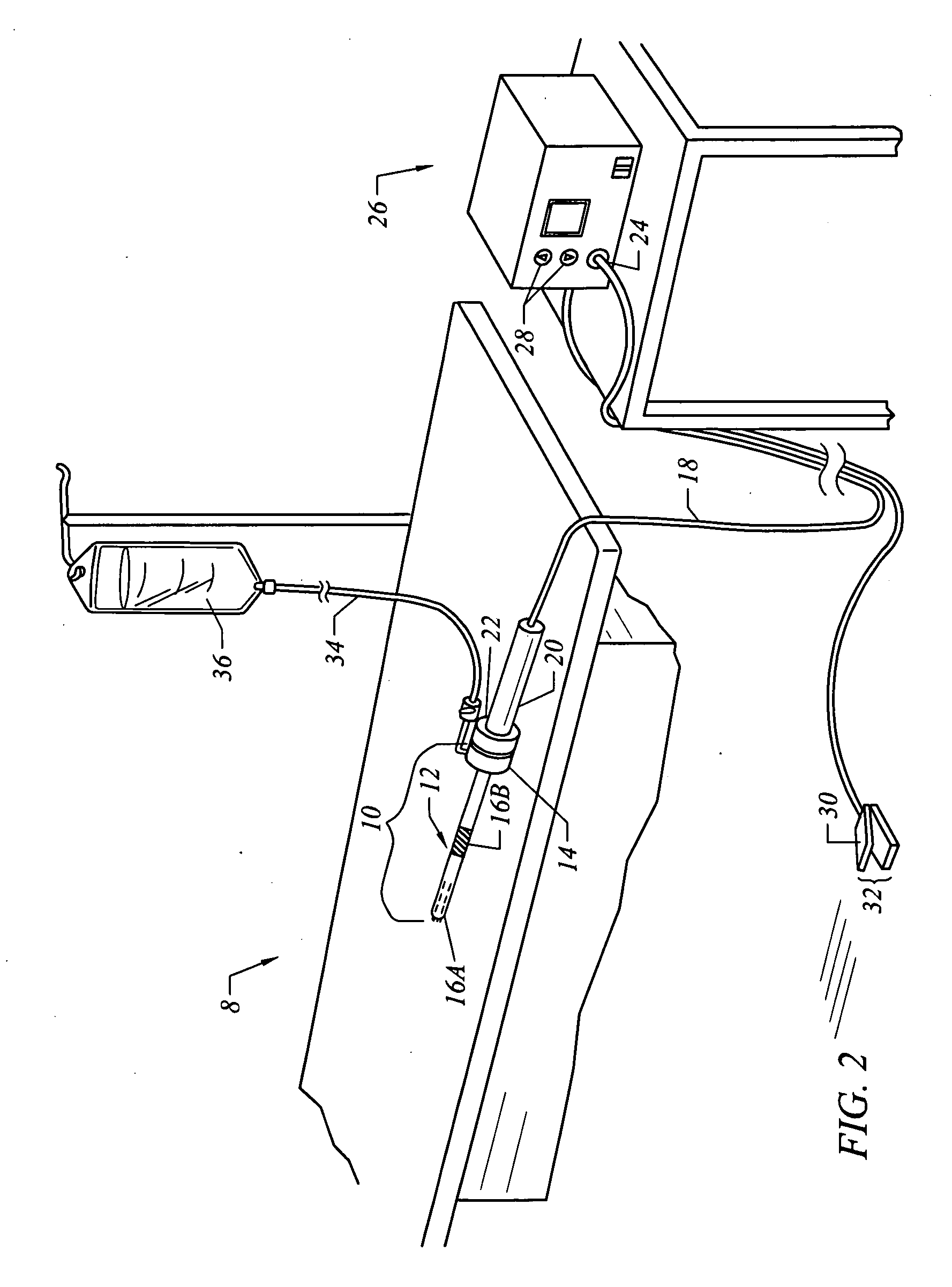 Electrosurgical method and system for treating foot ulcer