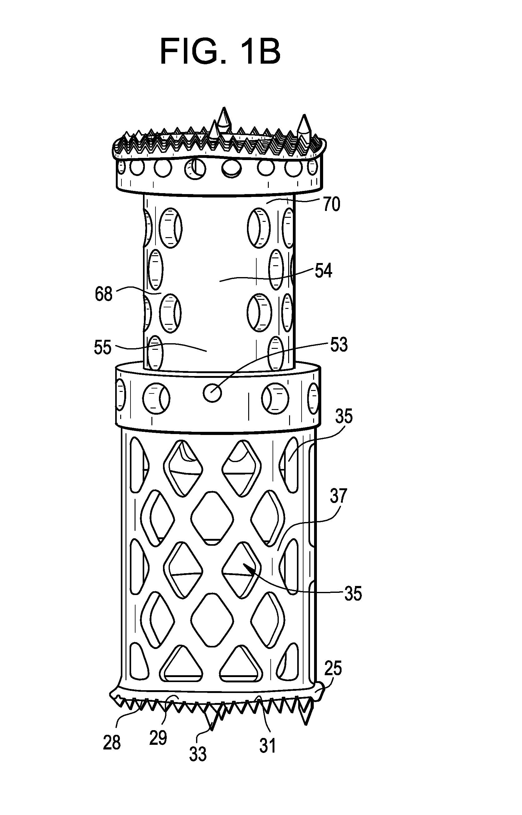 Expandable Corpectomy Spinal Fusion Cage