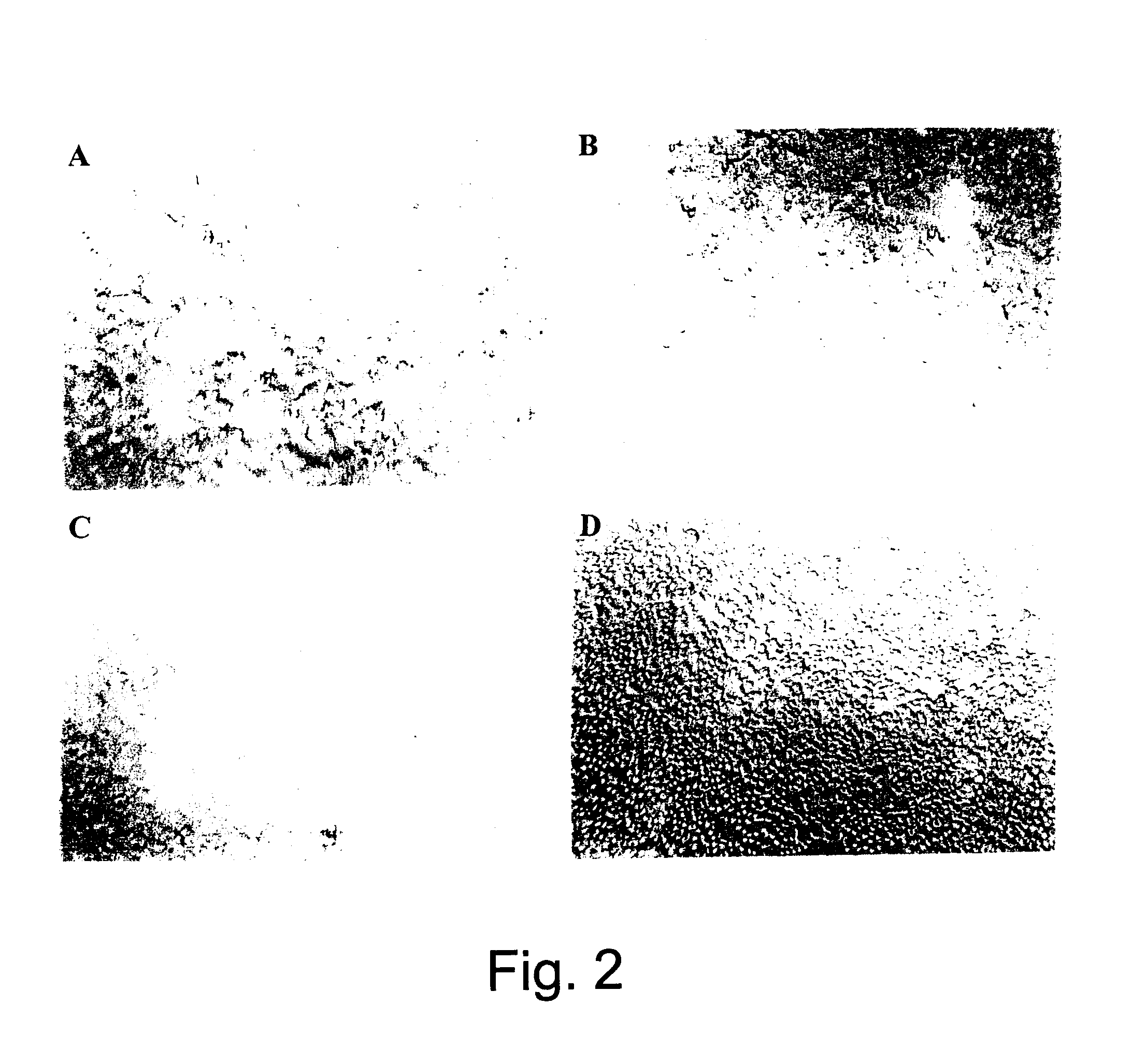 Use of one or more metal carriers to selectively kill mammalian cells