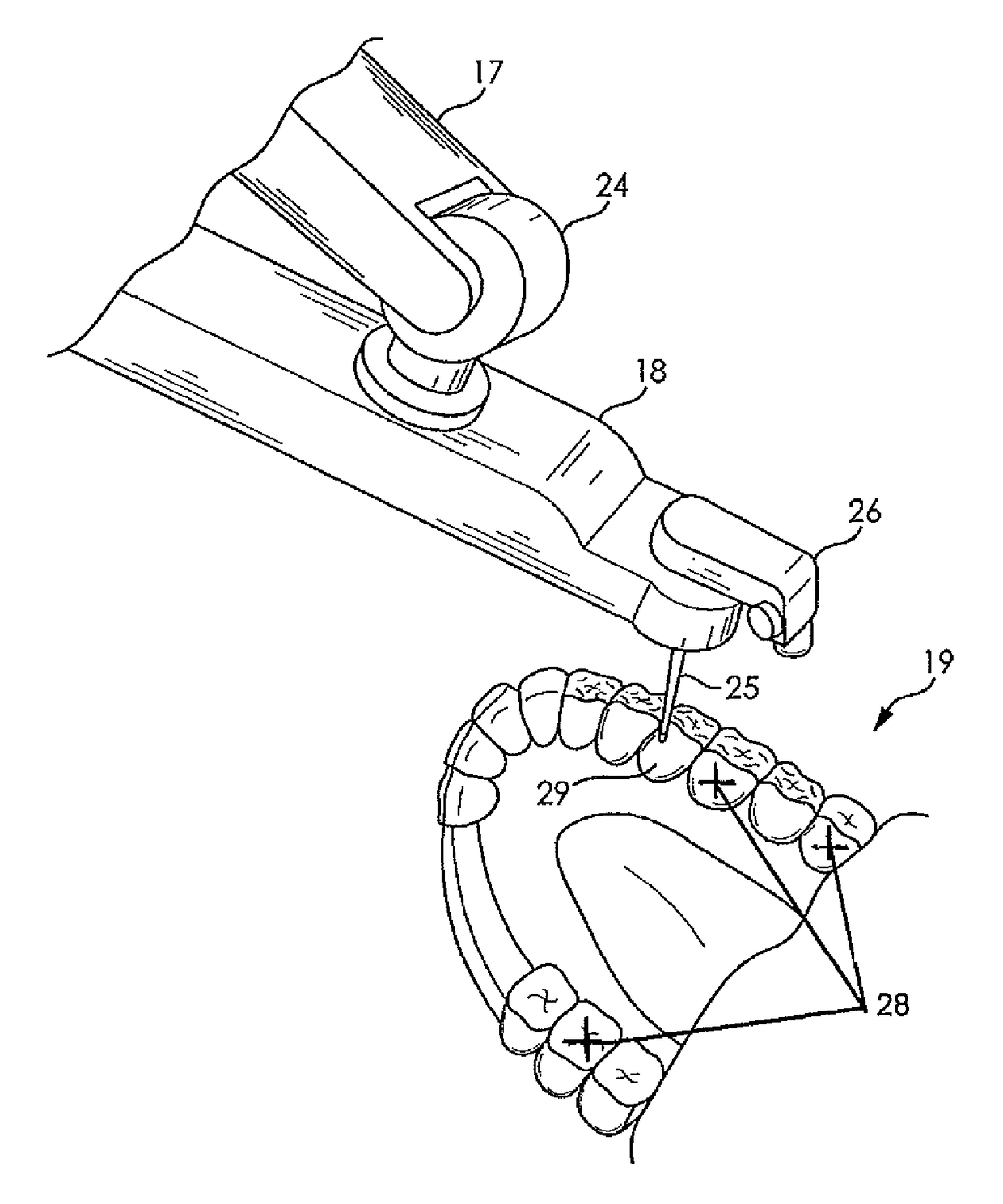 System and method for automating medical procedures