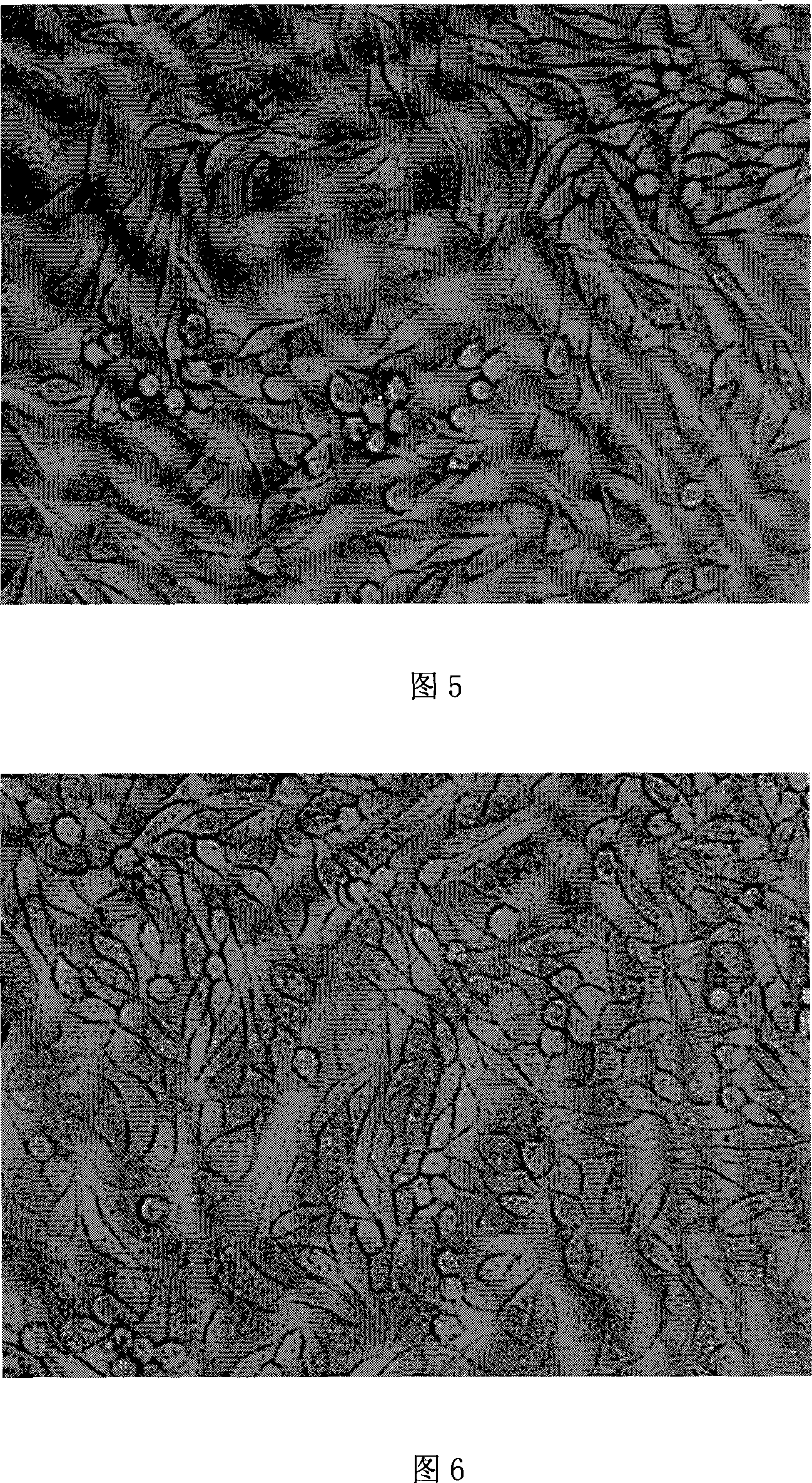 Method for preparing visible light solidified orthodontic binder containing 3-META functional monomer