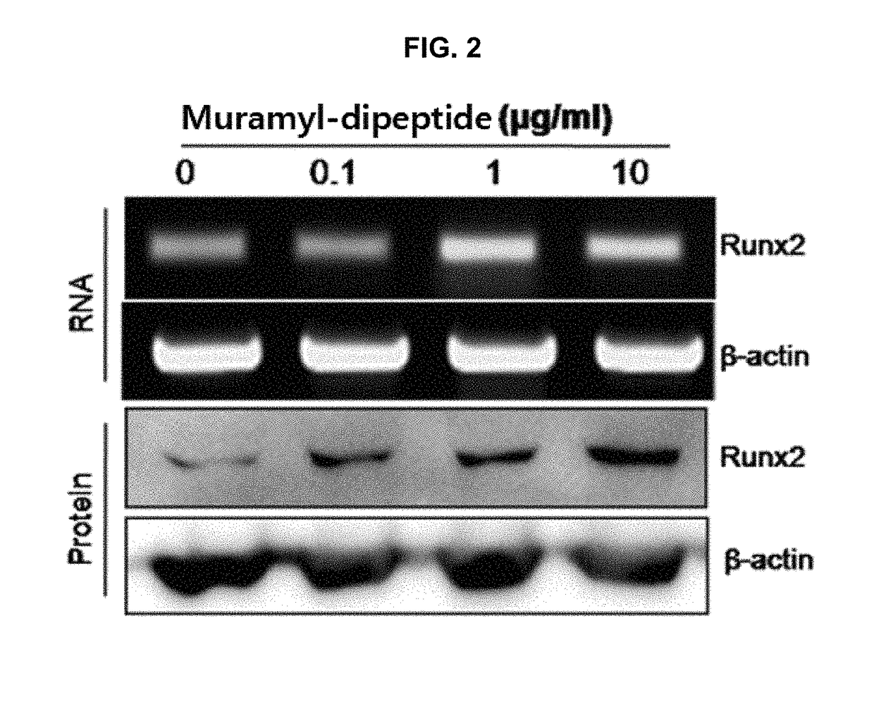 Bone loss preventing and bone regeneration or bone formation promoting pharmaceutical composition comprising muramyl dipeptide