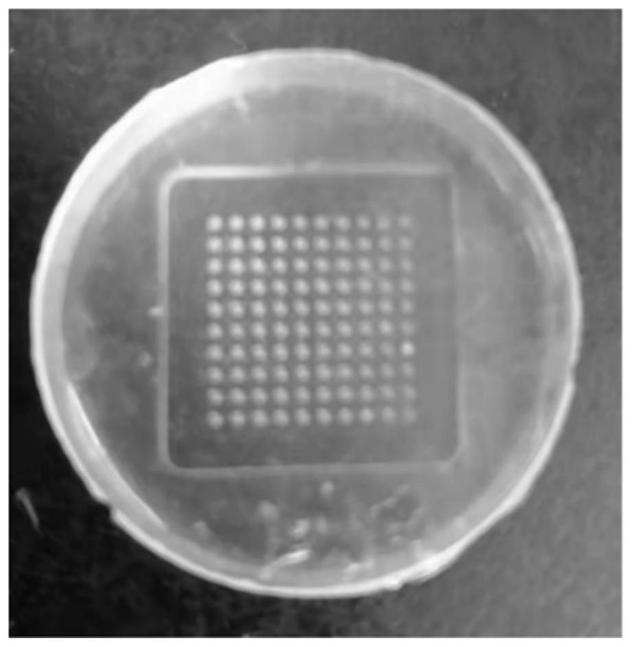 Microneedle patch, miniature blood glucose concentration detection system and biomarker detection system