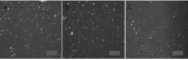 Primary isolated culture and induced differentiation method for precursor fat cells in adult yak muscles