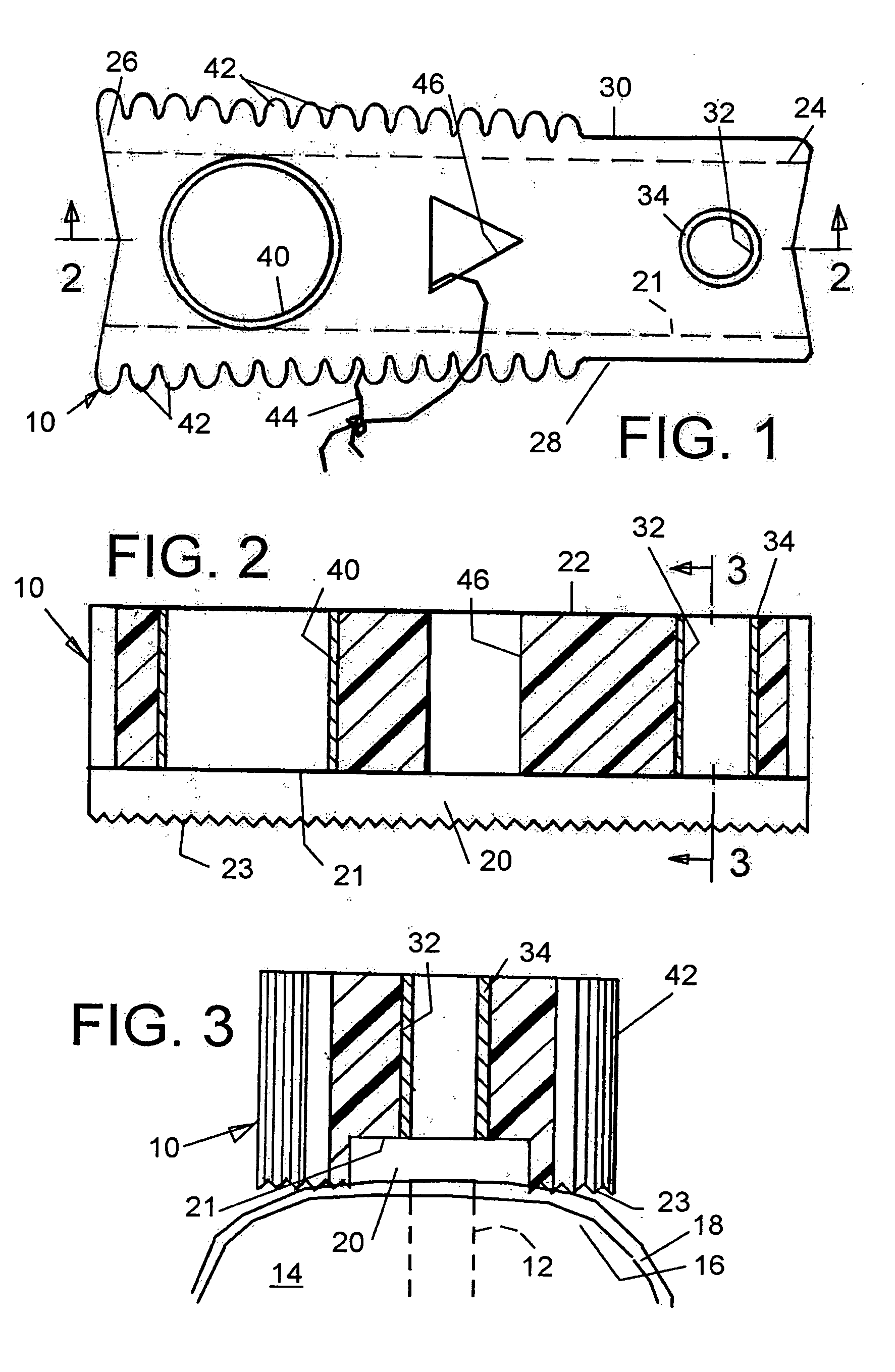 Hole guide for mini and standard dental implants