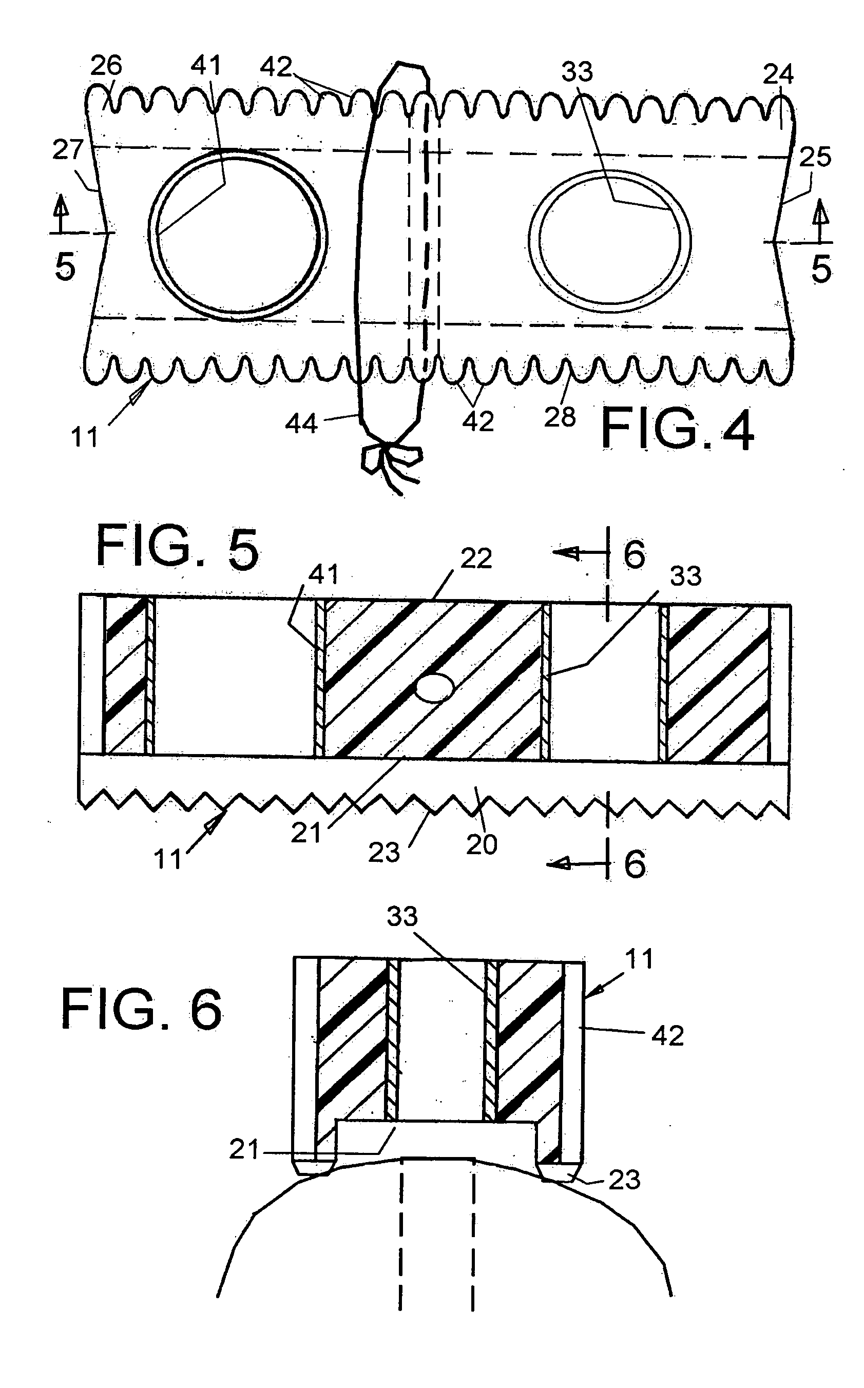 Hole guide for mini and standard dental implants