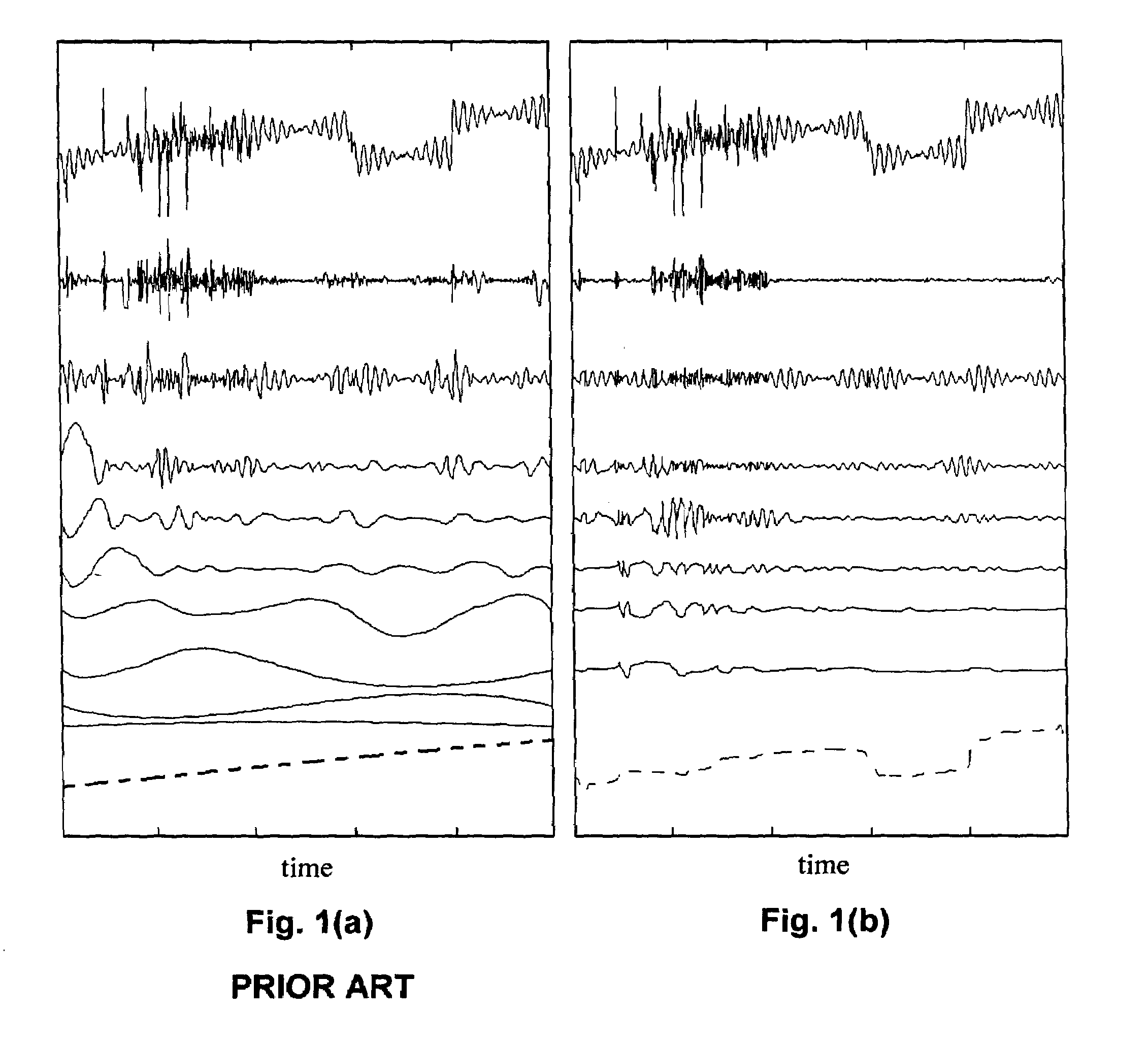 Method, computer program, and system for intrinsic timescale decomposition, filtering, and automated analysis of signals of arbitrary origin or timescale