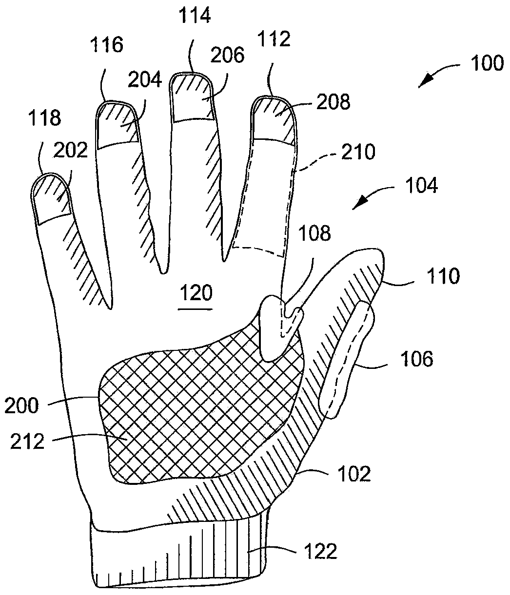 Glove having injection molded components