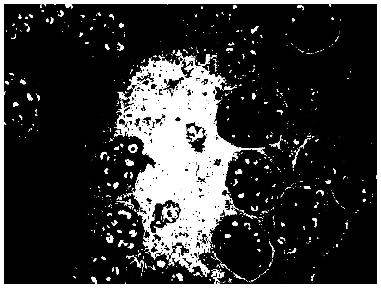 Mixed bean dietary fiber and enzymic method preparation method and application thereof