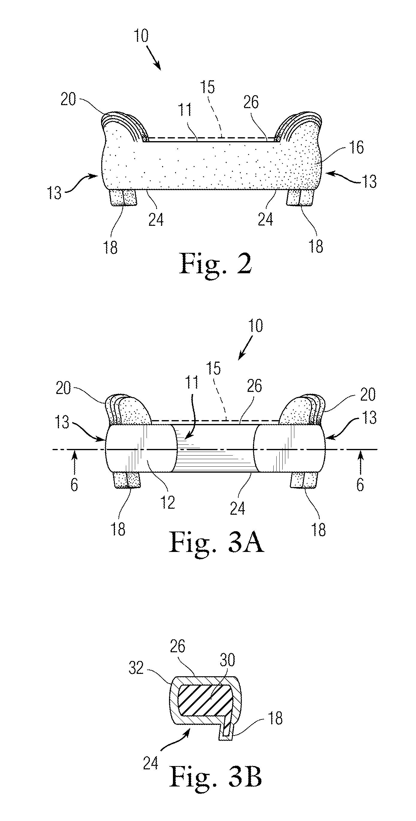 Facial sculpturing dental appliance