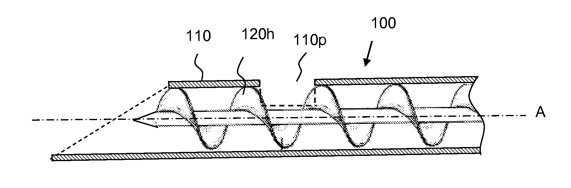 Method and device for tissue removal and for delivery of a therapeutic agent or bulking agent