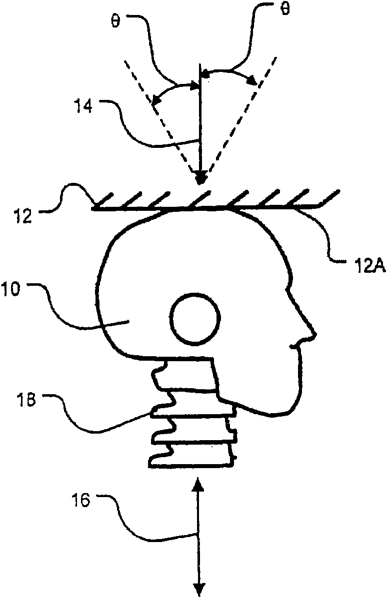 Apparatus for mitigating spinal cord injury