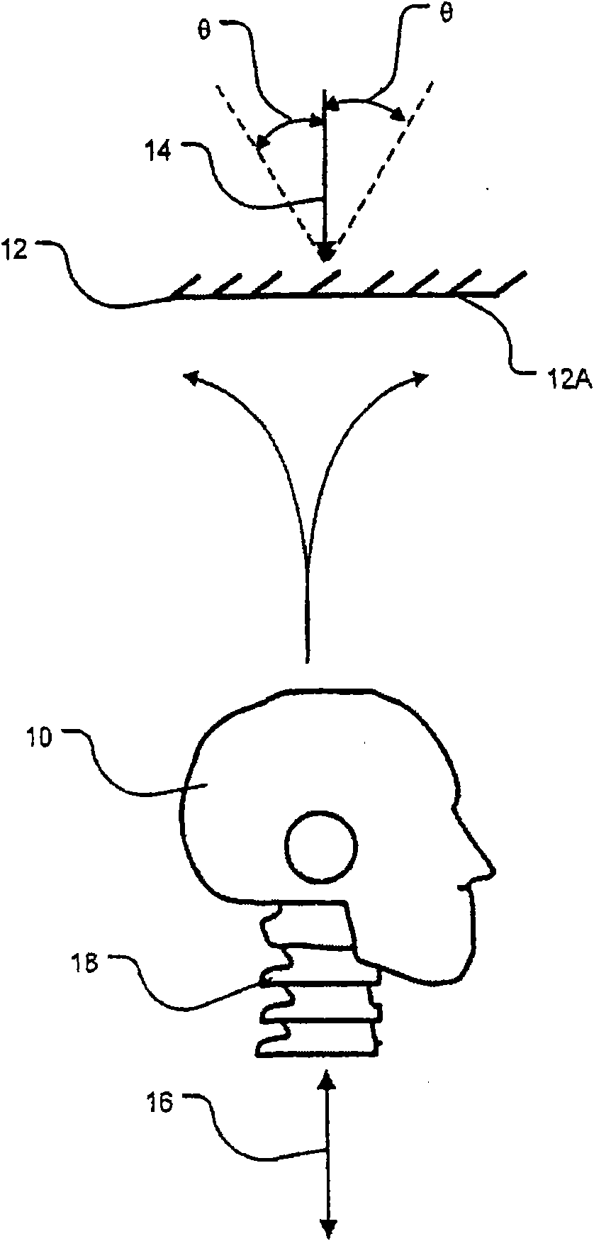 Apparatus for mitigating spinal cord injury