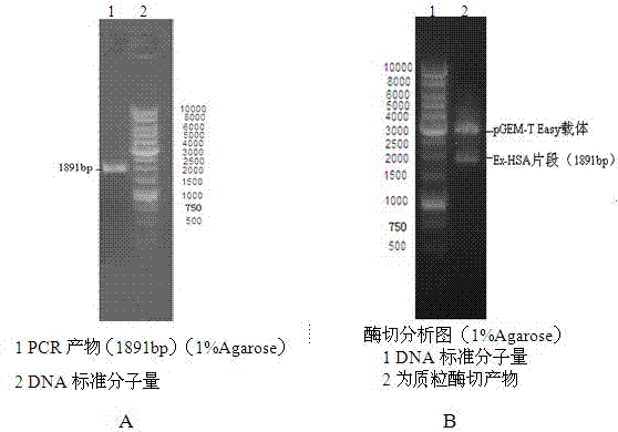 Fusion protein of exendin-4 peptide and human serum albumin (HSA) and preparation method thereof