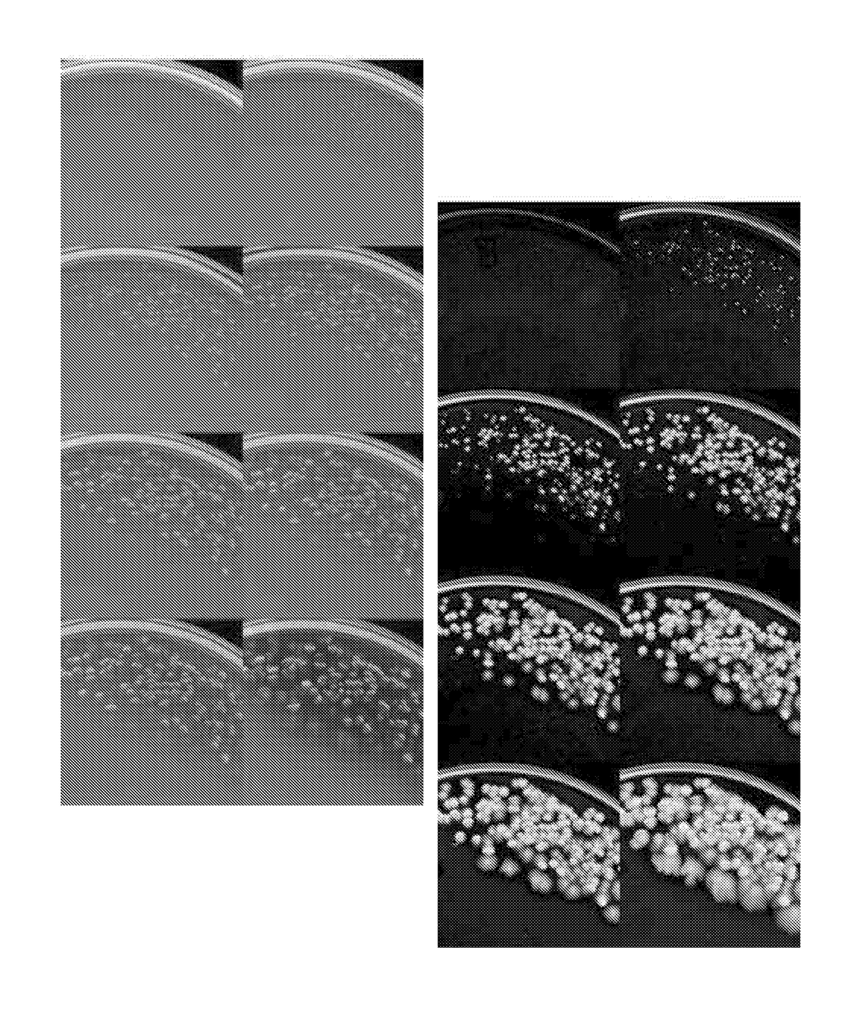 A method and system for automated microbial colony counting from streaked saple on plated media