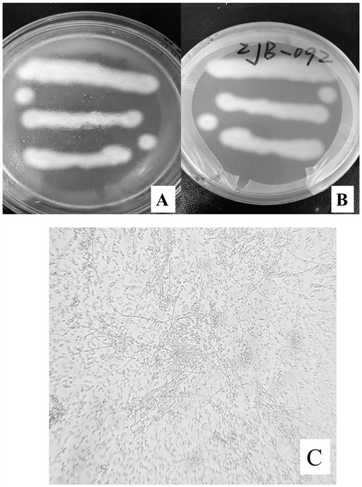 Odorless improved microbial agent for kitchen waste treatment and its preparation method and application