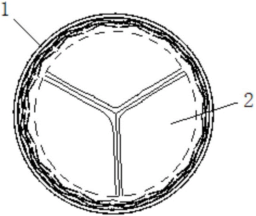 Ectopic implantation valved stent system for treating tricuspid regurgitation