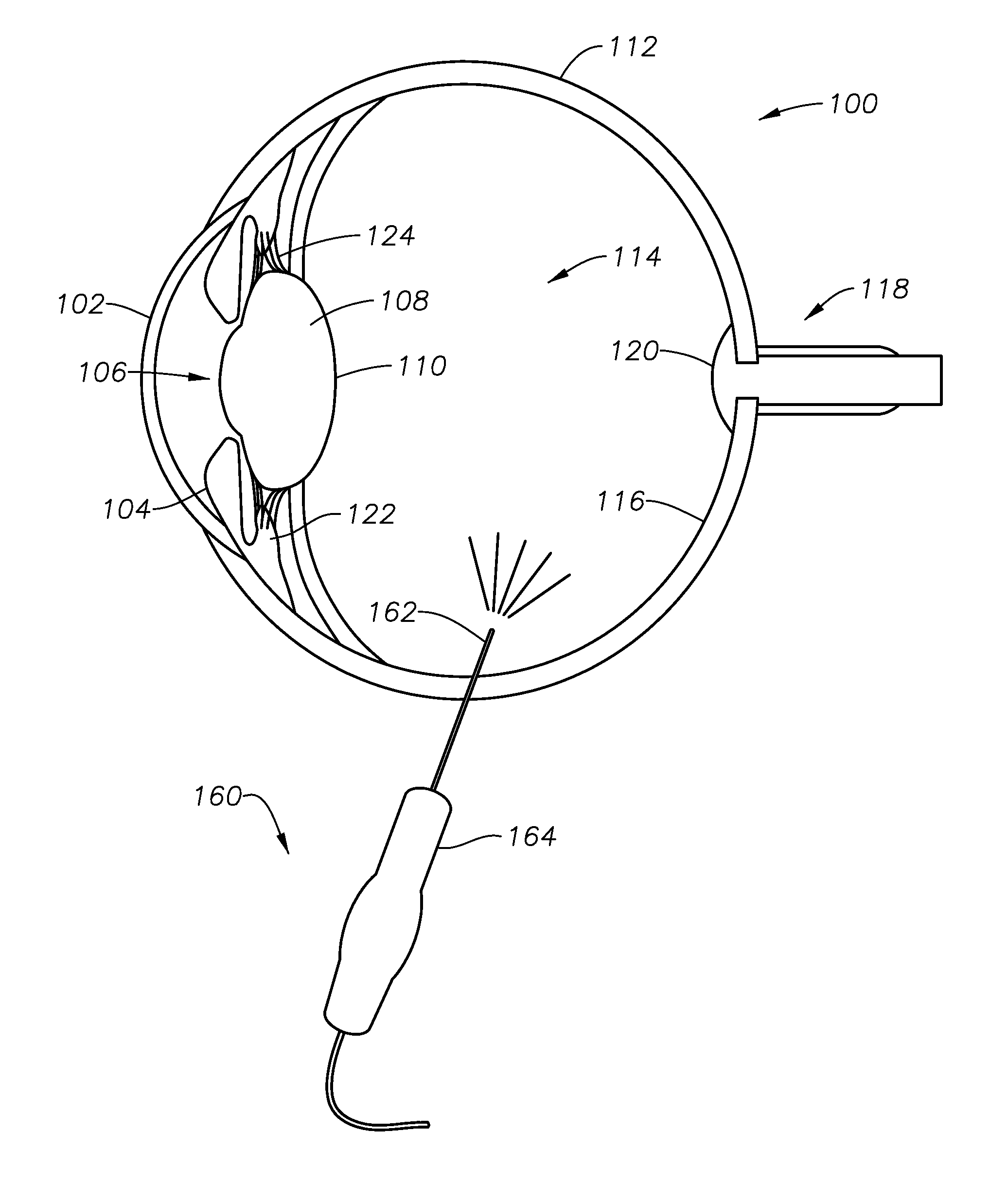 Single-fiber multi-spot laser probe for ophthalmic endoillumination