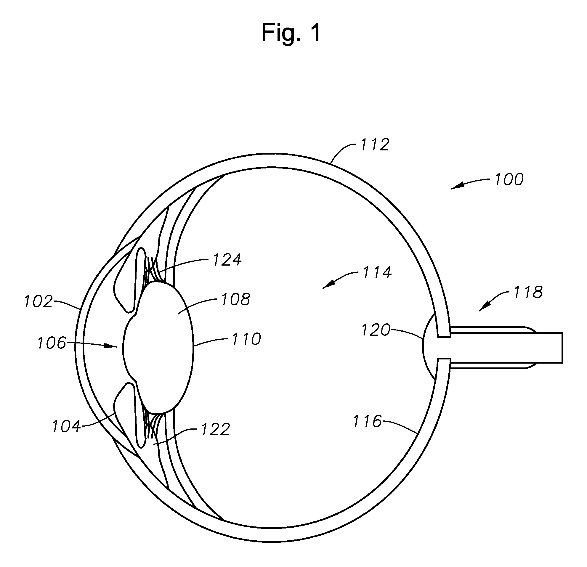 Single-fiber multi-spot laser probe for ophthalmic endoillumination