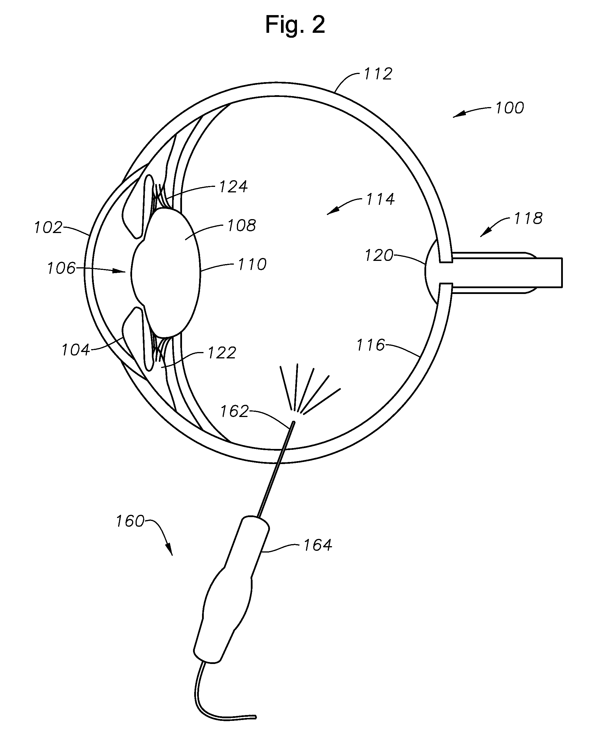 Single-fiber multi-spot laser probe for ophthalmic endoillumination