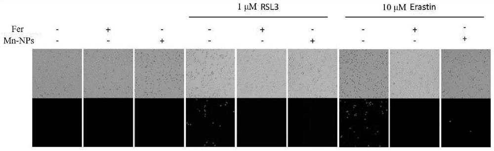 Manganese-based nano-enzyme as ferroptosis inhibitor and application of manganese-based nano-enzyme in liver injury