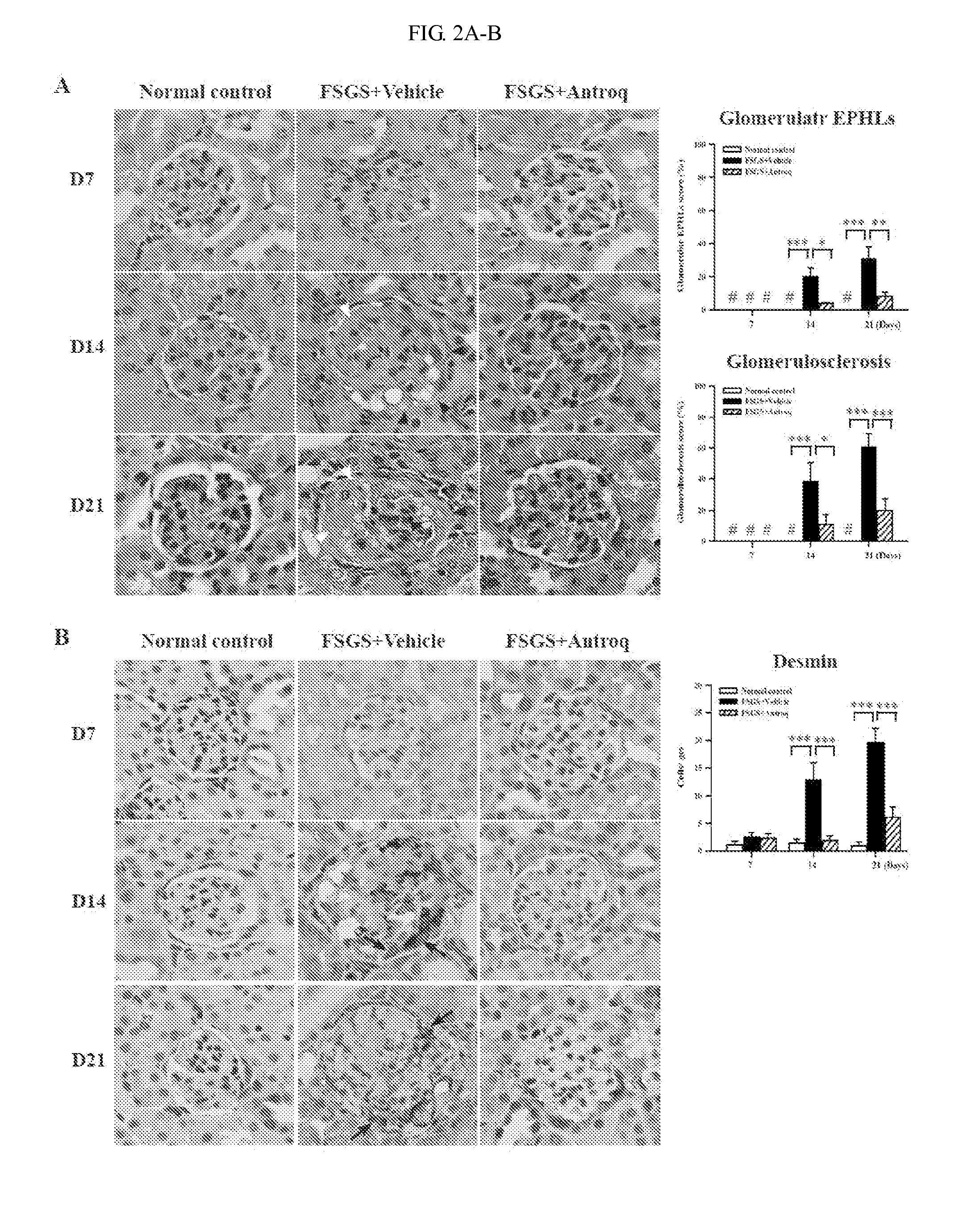 Methods and compositions for treating kidney disorders