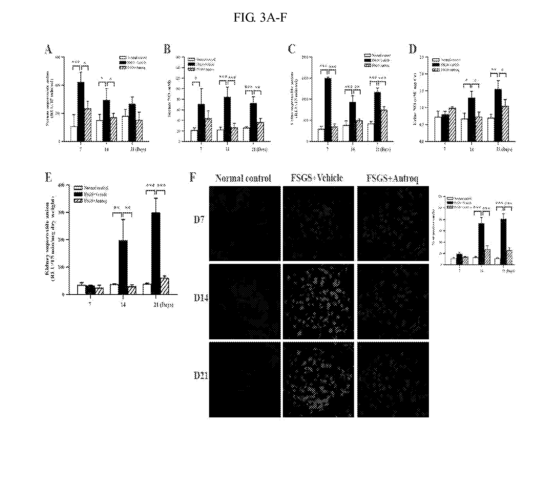 Methods and compositions for treating kidney disorders