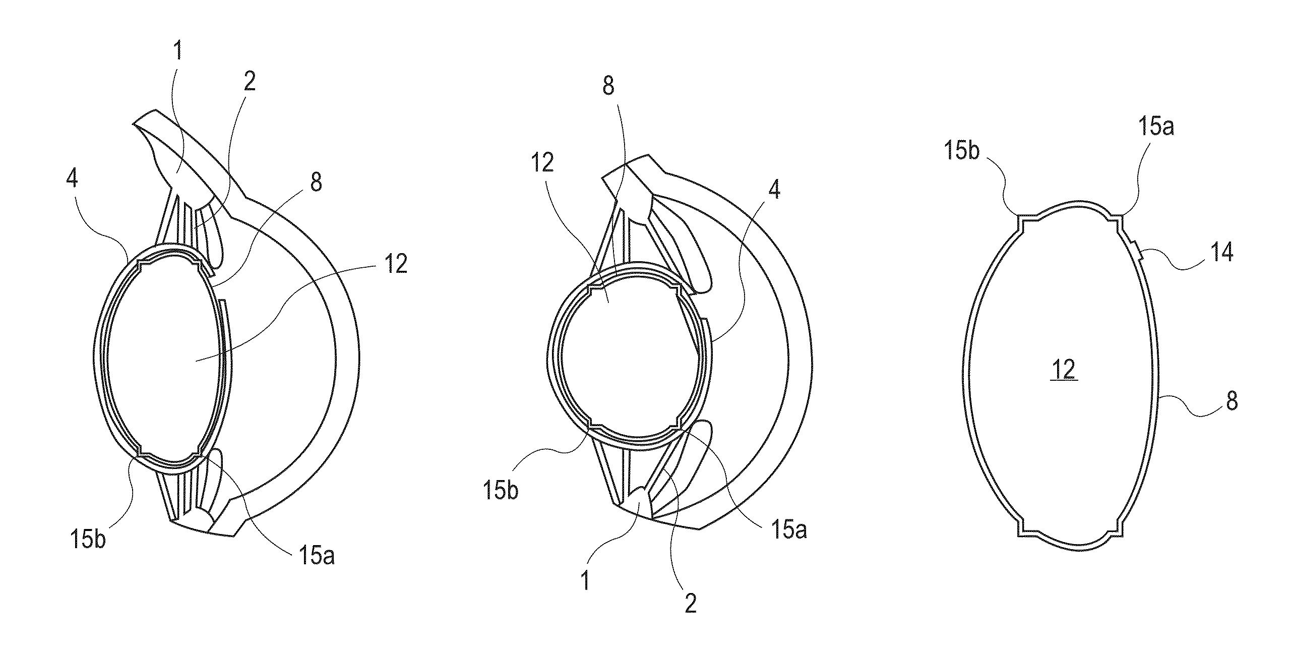 Accommodating intraocular lens