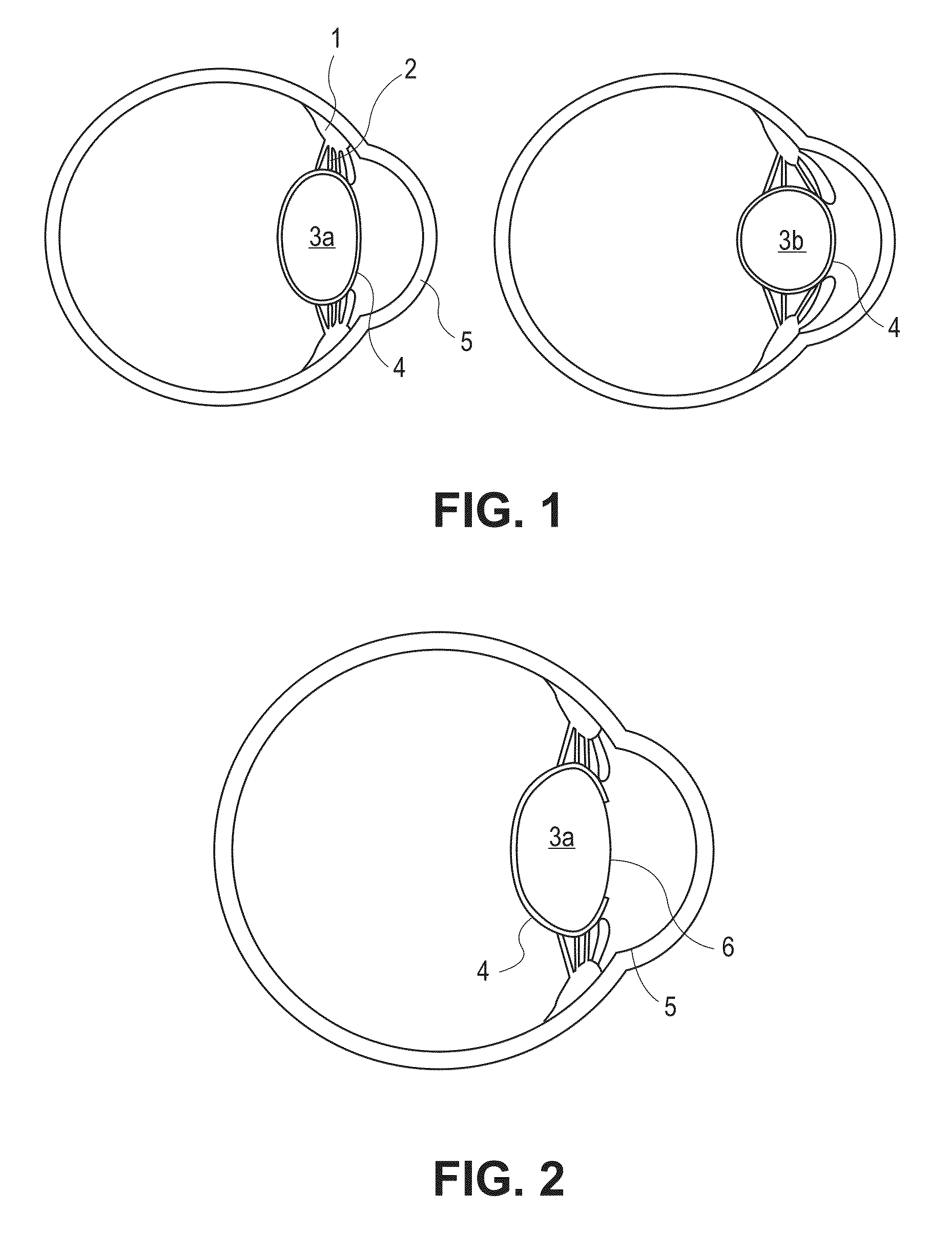 Accommodating intraocular lens