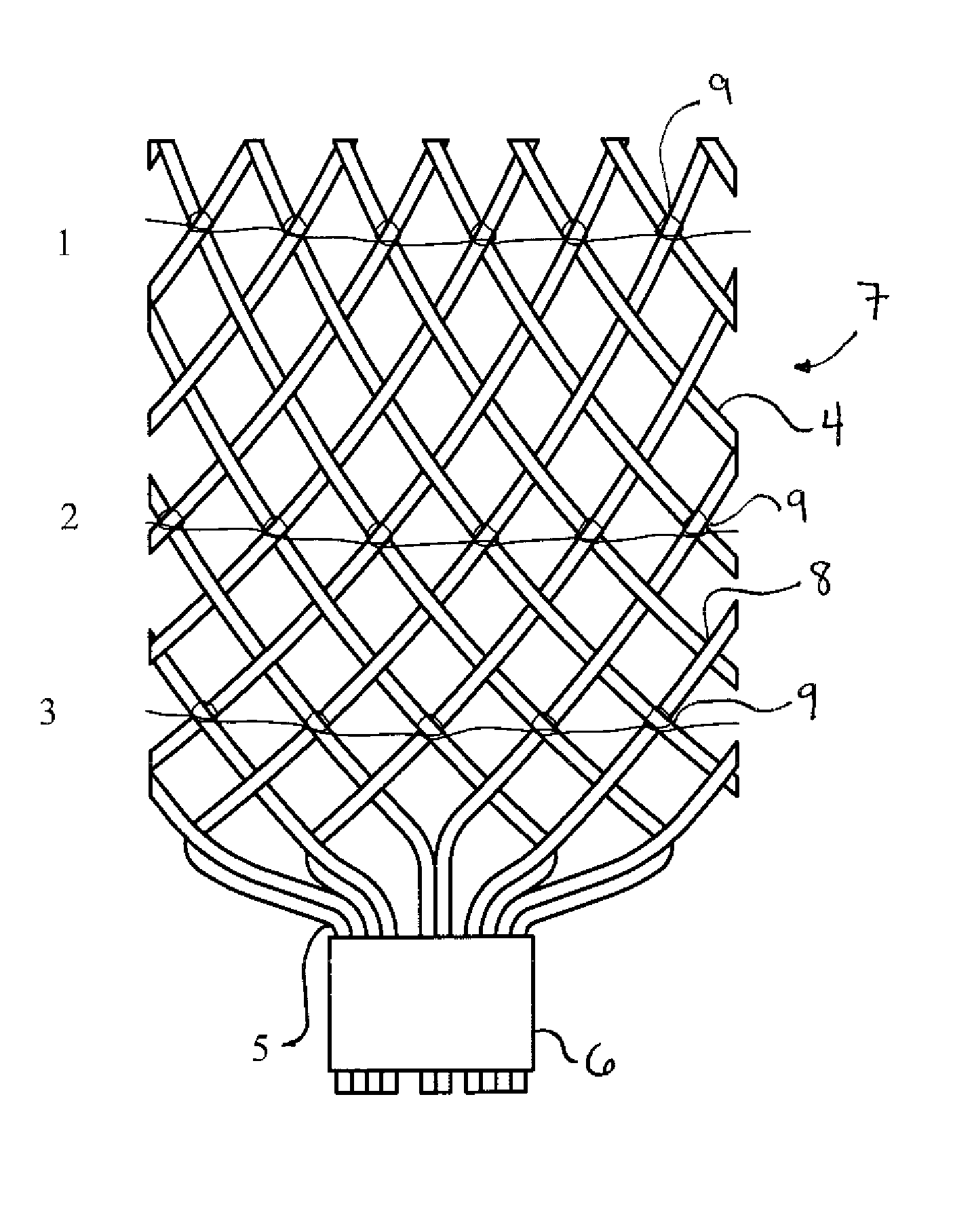 Modification of properties and geometry of heart tissue to influence function