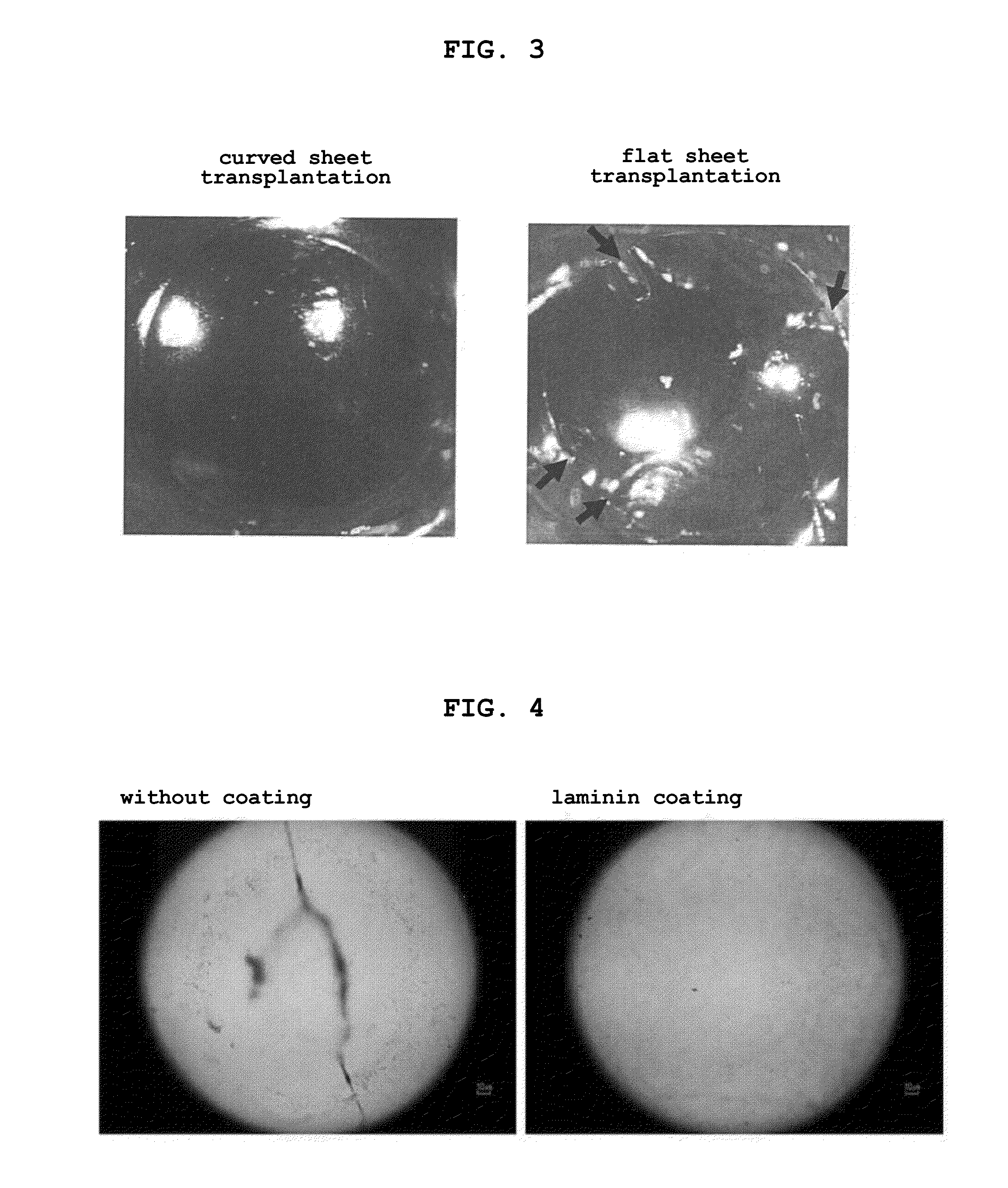 Human corneal endothelial cell sheet