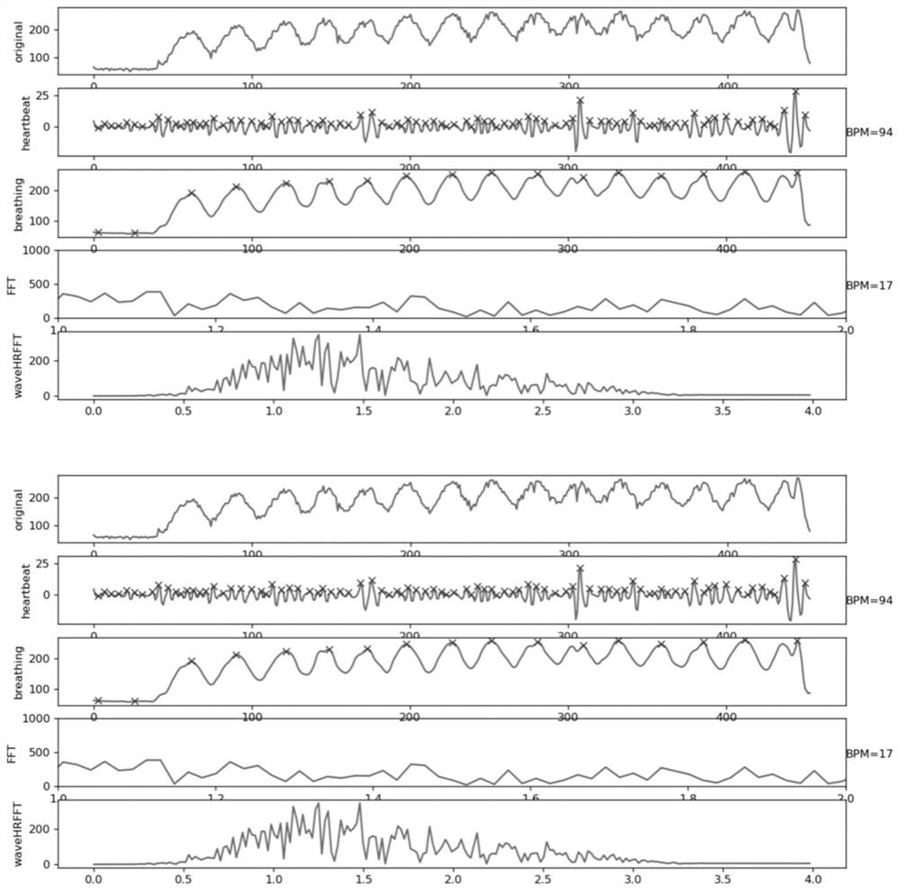 Non-contact breath or heartbeat detection method