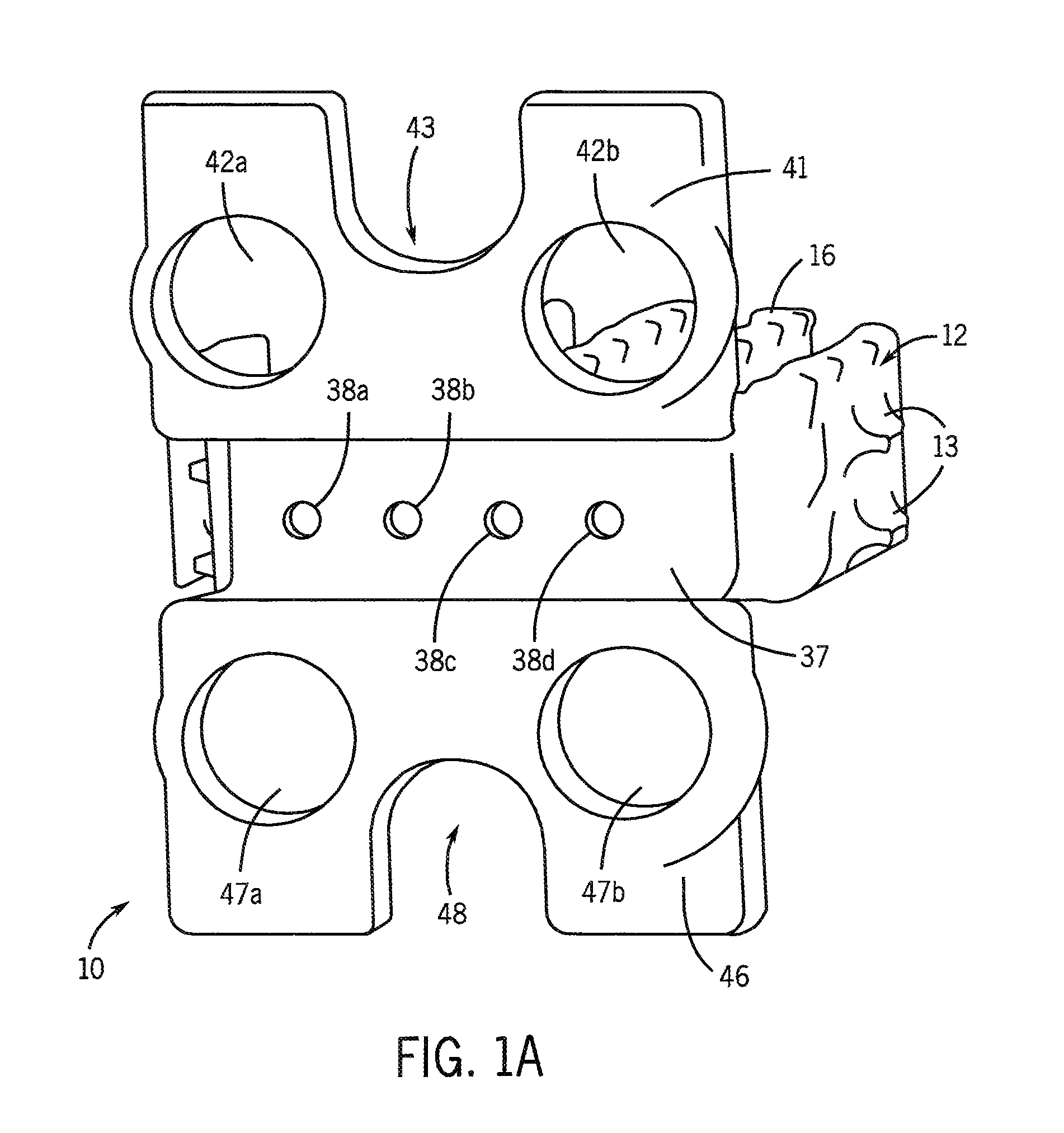 Degradable cage coated with mineral layers for spinal interbody fusion