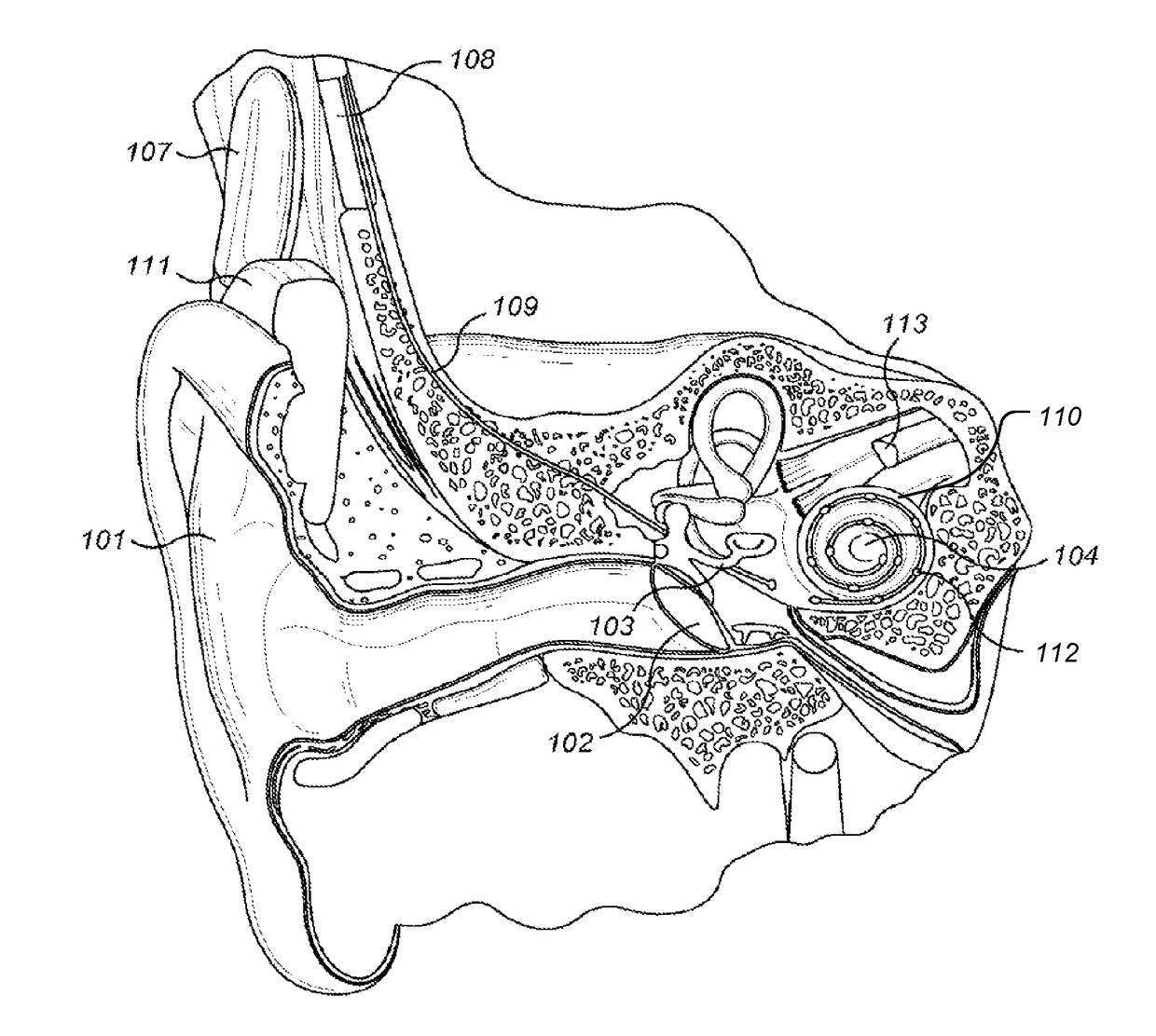 Interaural Coherence Based Cochlear Stimulation Using Adapted Envelope Processing