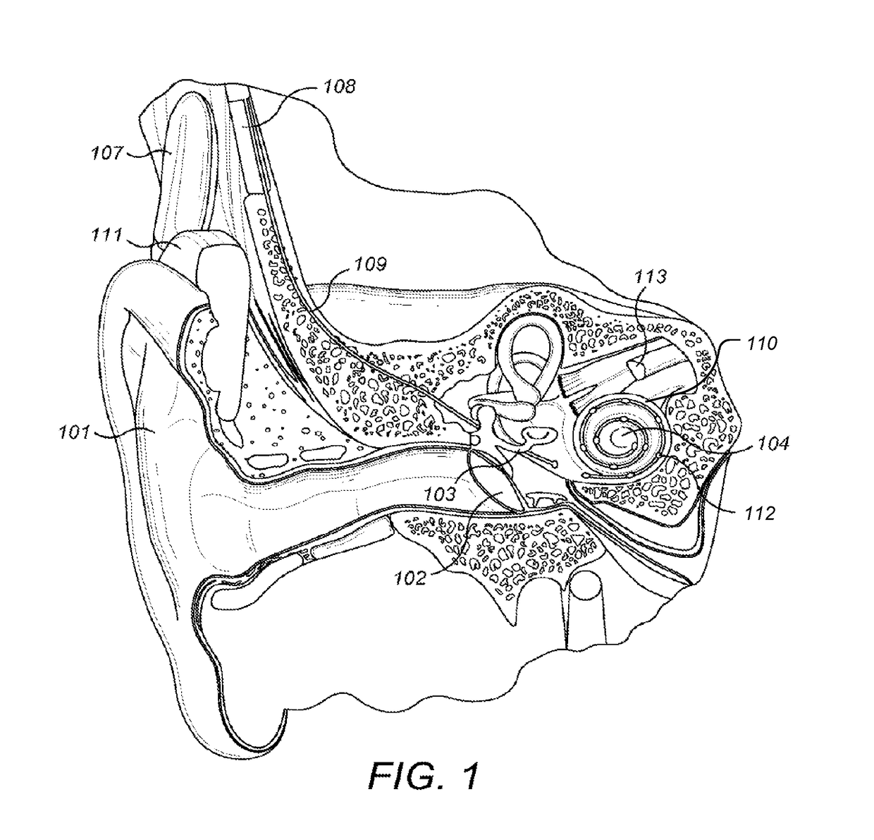 Interaural Coherence Based Cochlear Stimulation Using Adapted Envelope Processing