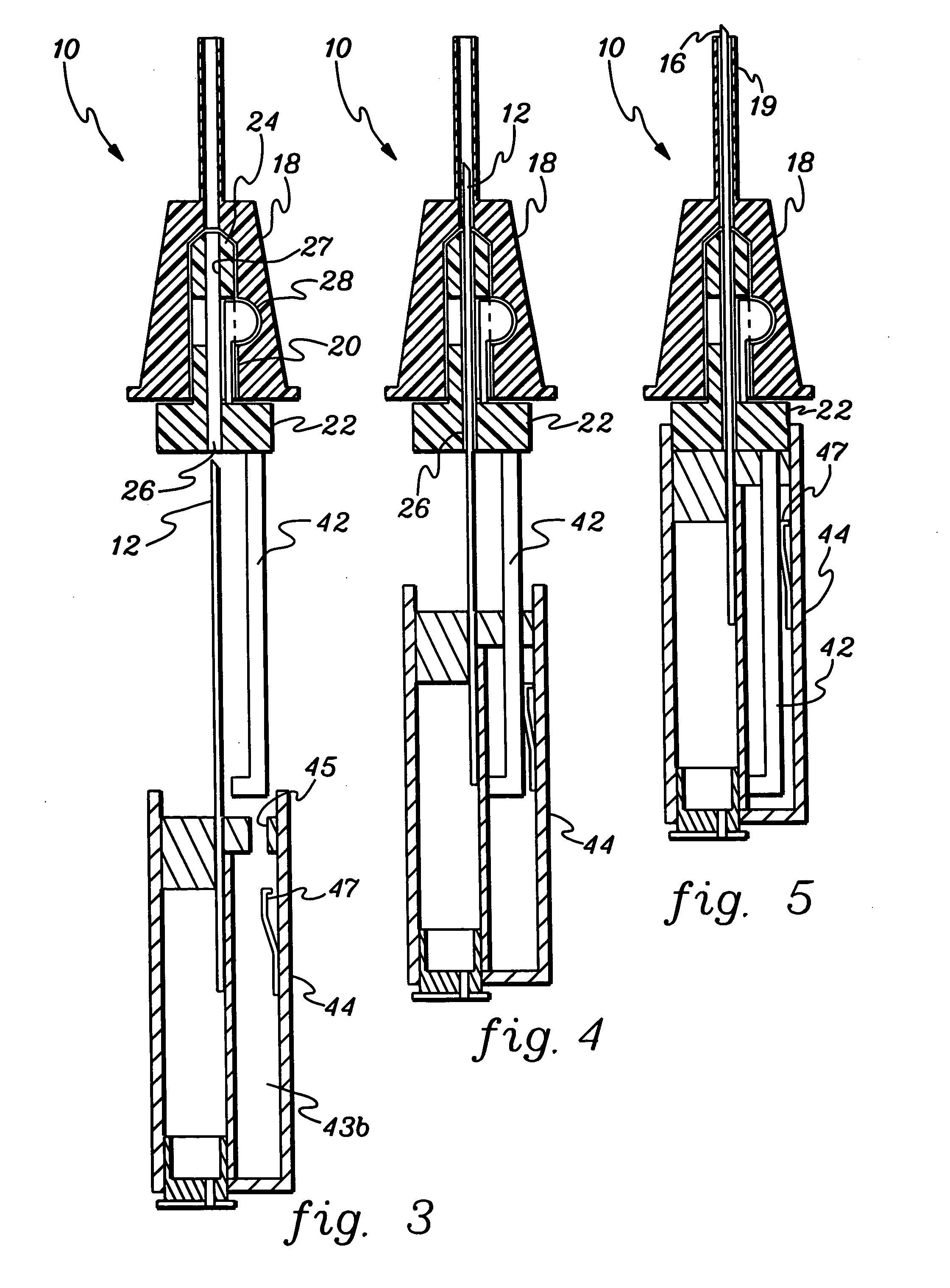 Safety intravenous catheter assembly