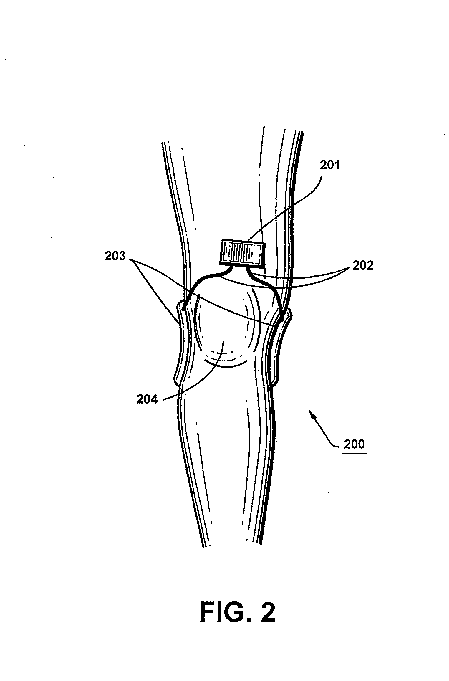 Apparatus and method for electromagnetic treatment