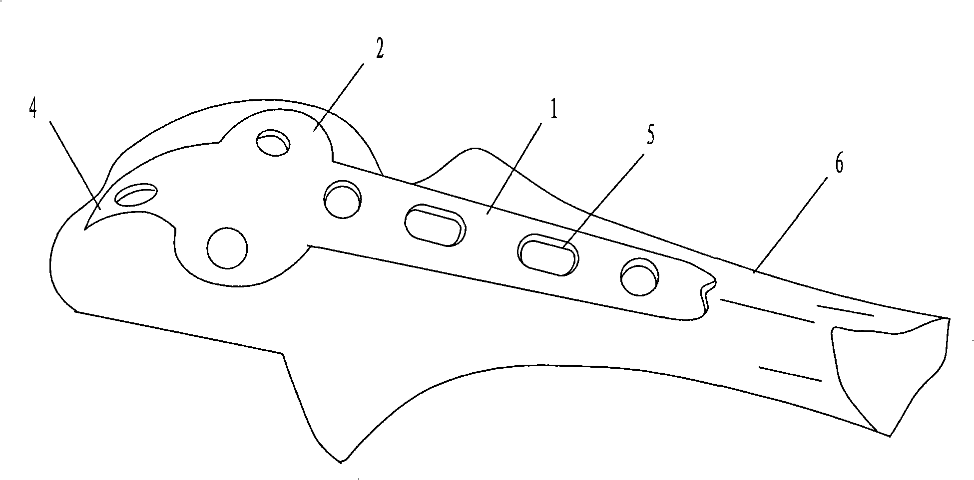 Tension side-fixing bone plate for olecranon process of ulna