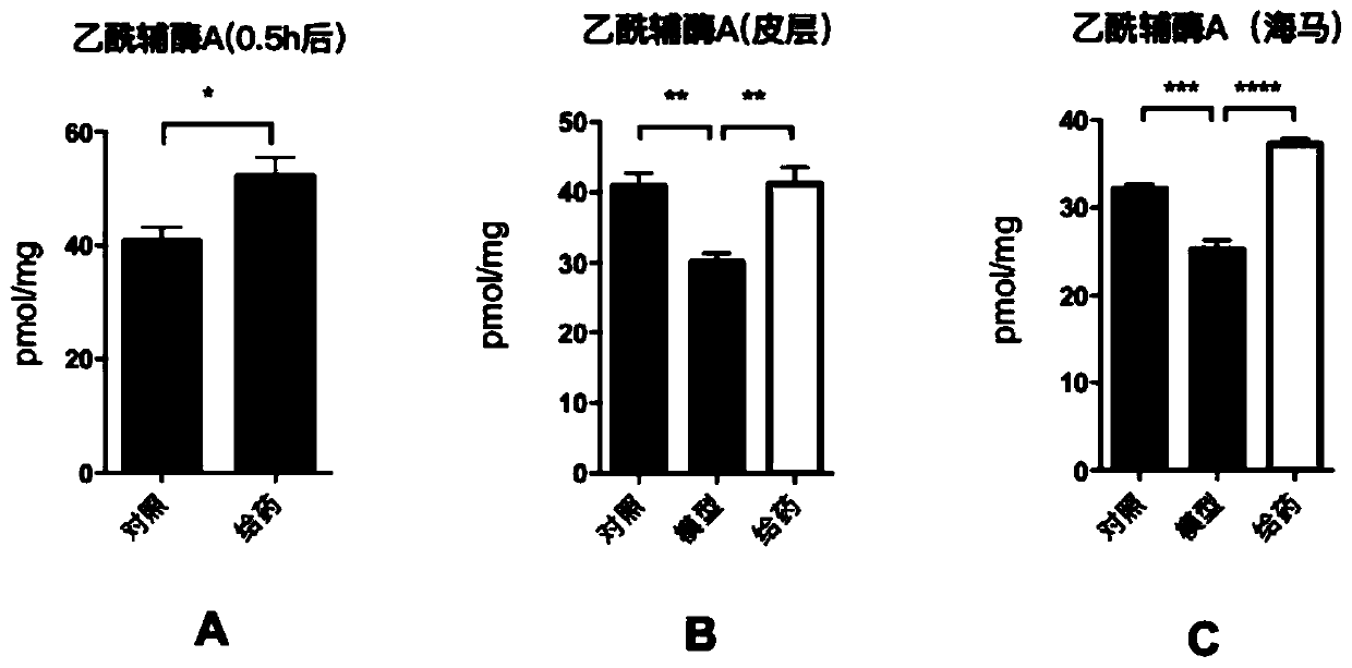 Application of glycerol triacetate to preparation of medicines for preventing and treating depression