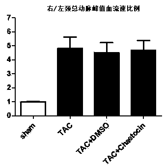 Application of chaetocin in preparation of medicine used for preventing and treating heart diseases